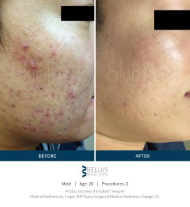 Before and After Image6